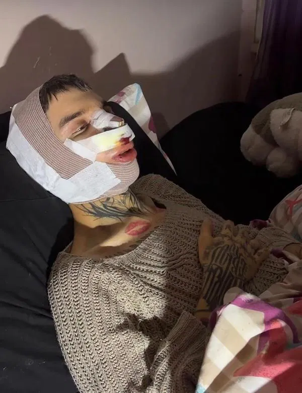 ‘Tablet Reis’ estetik ameliyat oldu