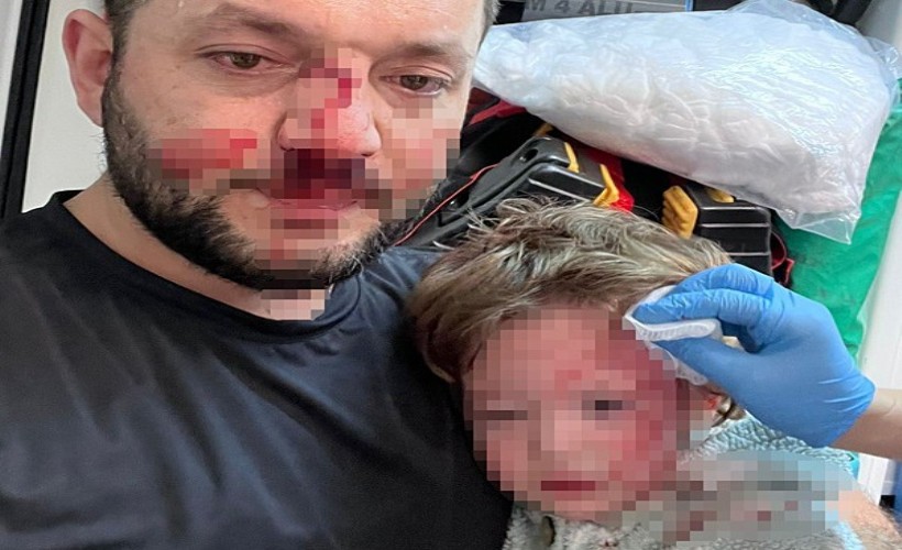 Kan donduran komşu dehşeti! 14 aylık bebeğiyle darbedildi!