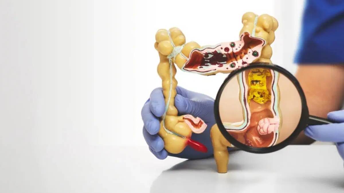 Bağırsak sağlığını tehdit eden 5 besin grubu